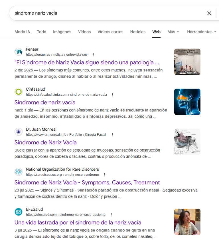 El Síndrome de Nariz Vacía ya no está ausente en Internet